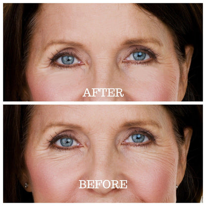 Under Eye Wrinkle Patches | Reusable Skin Plumping Eye Mask