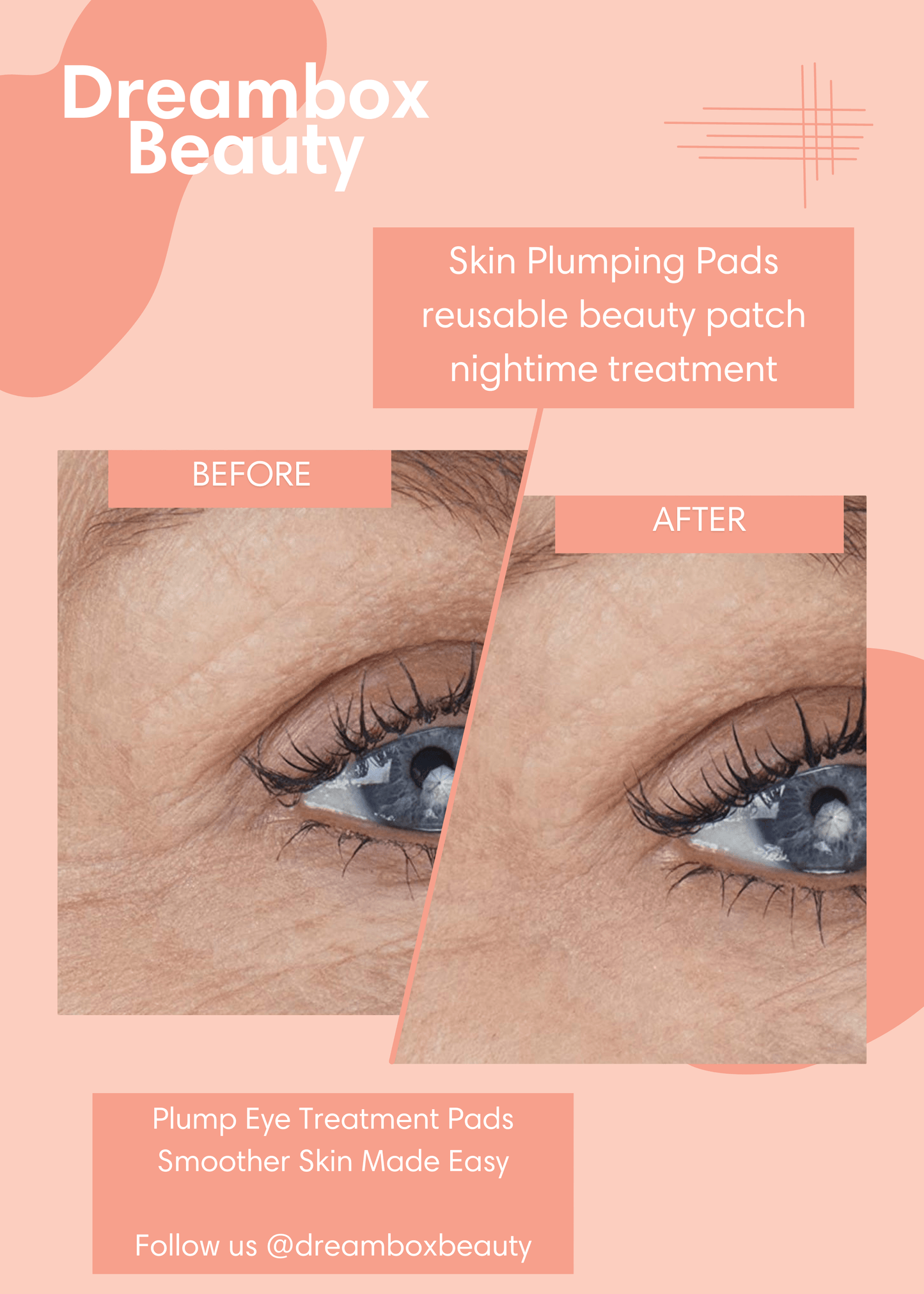 Under Eye Wrinkle Patches | Reusable Skin Plumping Eye Mask