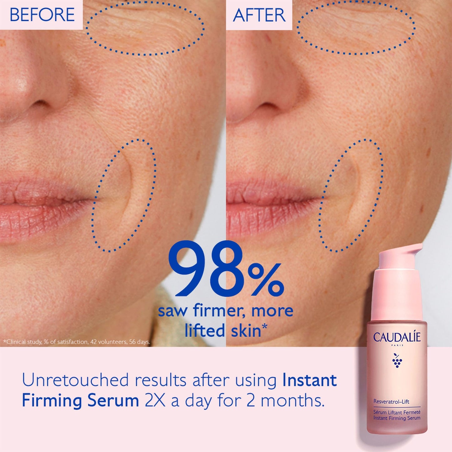 Caudalie Resveratrol Lift Firming Serum - Anti-Aging, Firming & Lifting Serum with Resveratrol for Youthful Skin