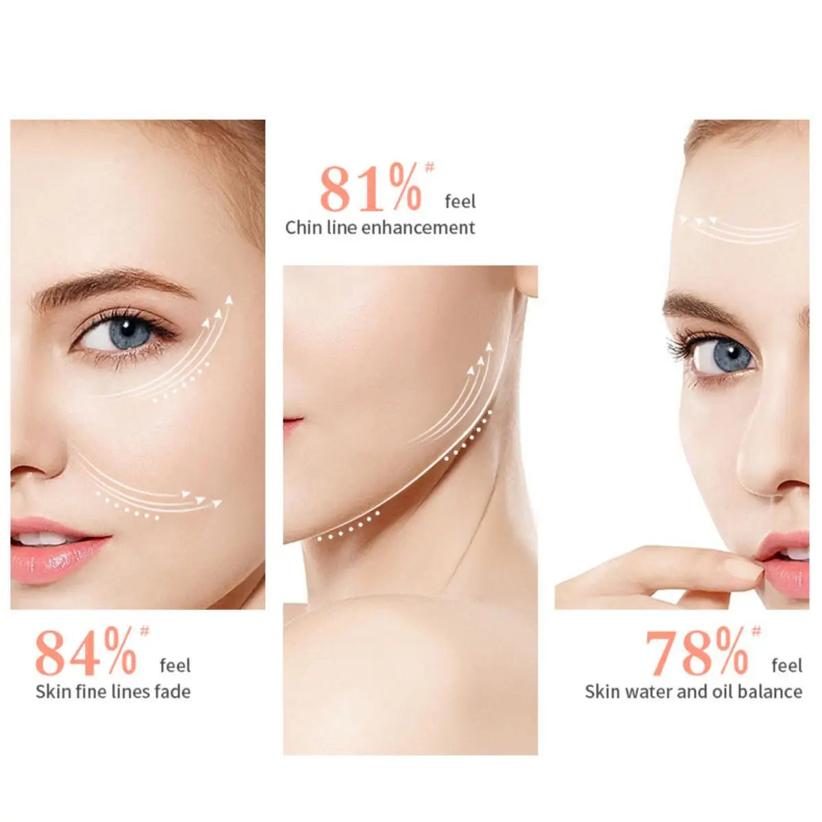 White-