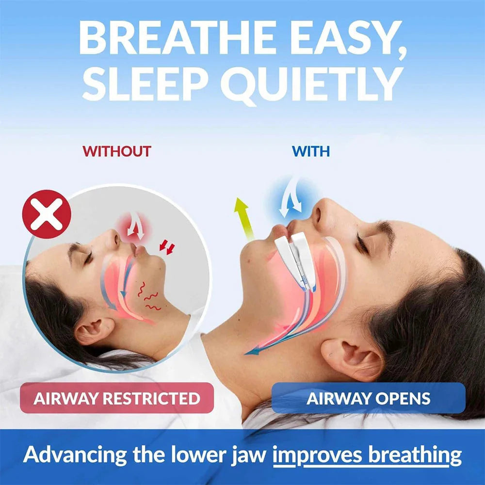 Anti-Snoring Mouthpiece – Adjustable Night Mouth Guard for Snoring