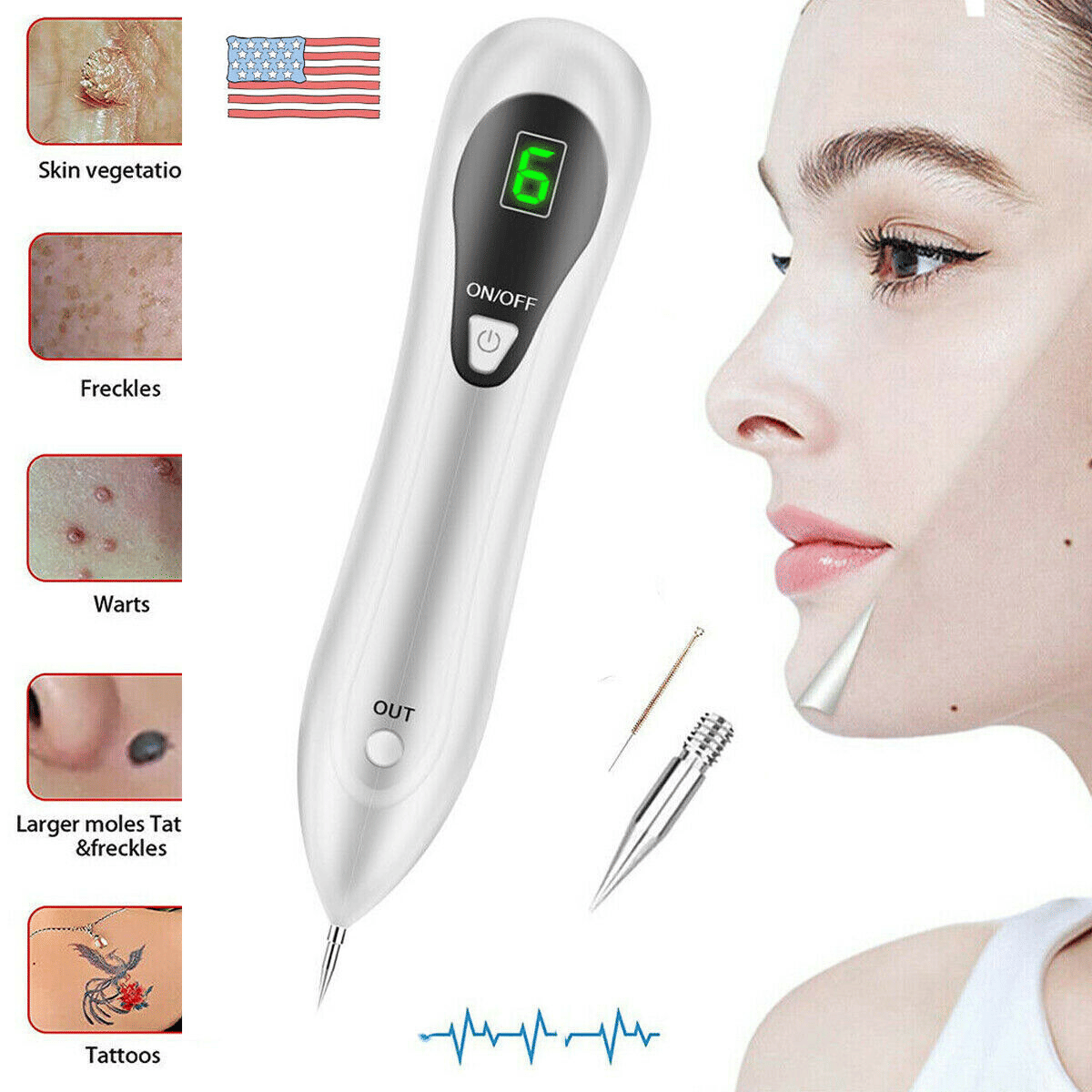 Electric Laser Plasma Pen Mole Removal Dark Spot Remover Skin Wart Tag Tattoo