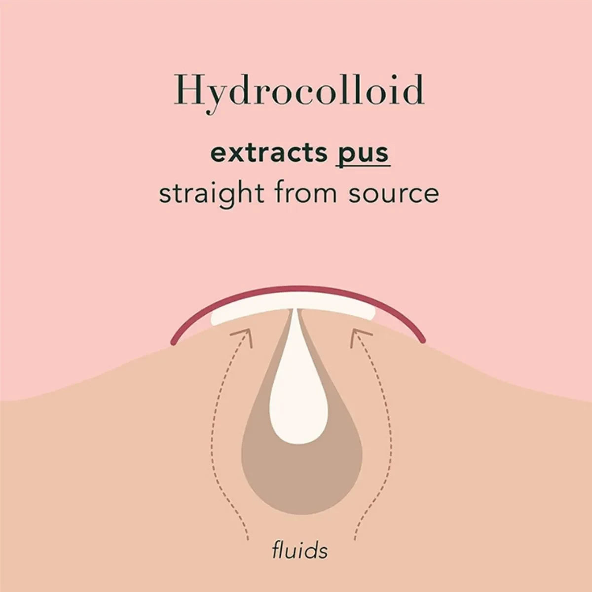 Ultra-Thin Waterproof Acne Spot Patches