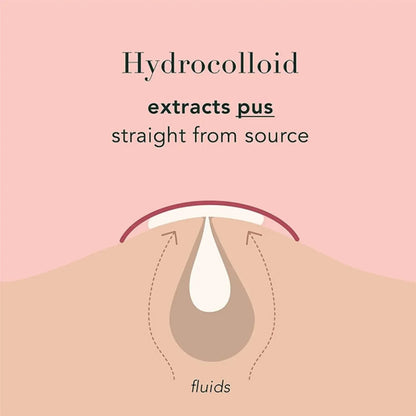 Ultra-Thin Waterproof Acne Spot Patches