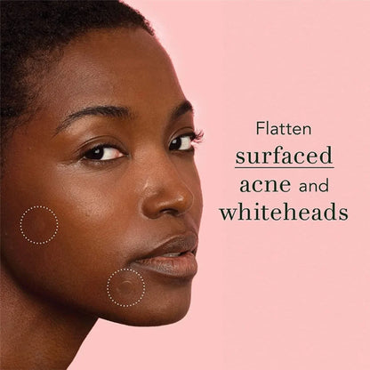 Ultra-Thin Waterproof Acne Spot Patches